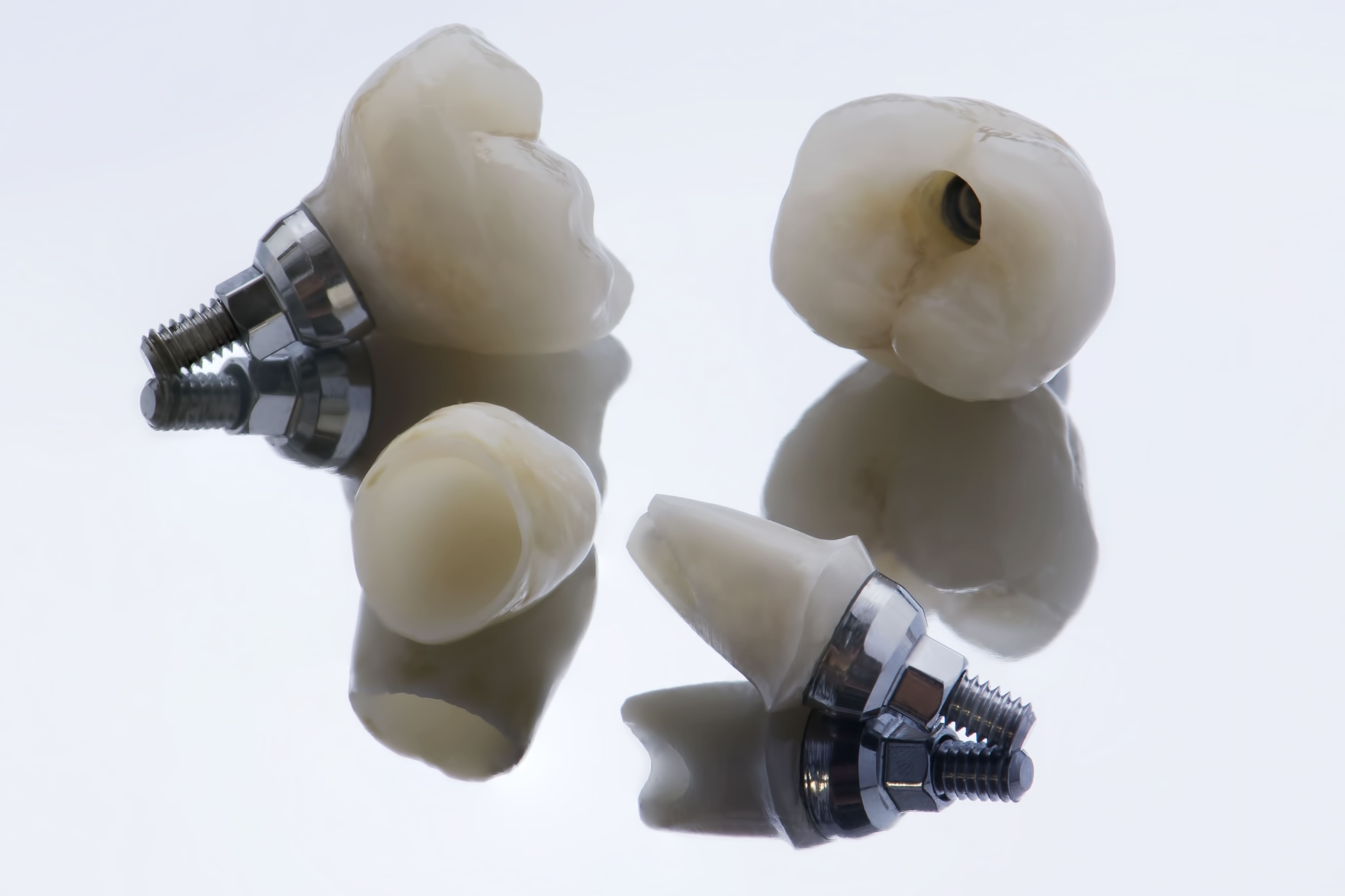 Циркониевые импланты для передних зубов