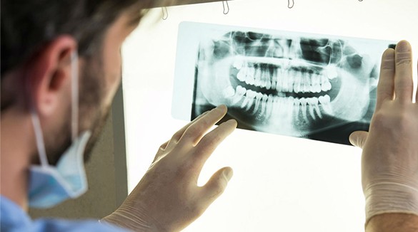 Фото врач-стоматолог изучает панорамный снимок зубов