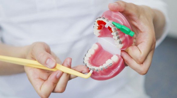 Стоматолог-ортодонт проводит консультацию