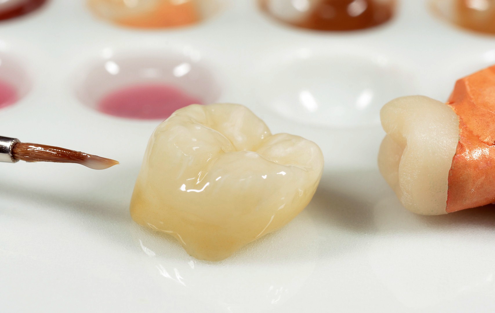 Микропротезирование зуба