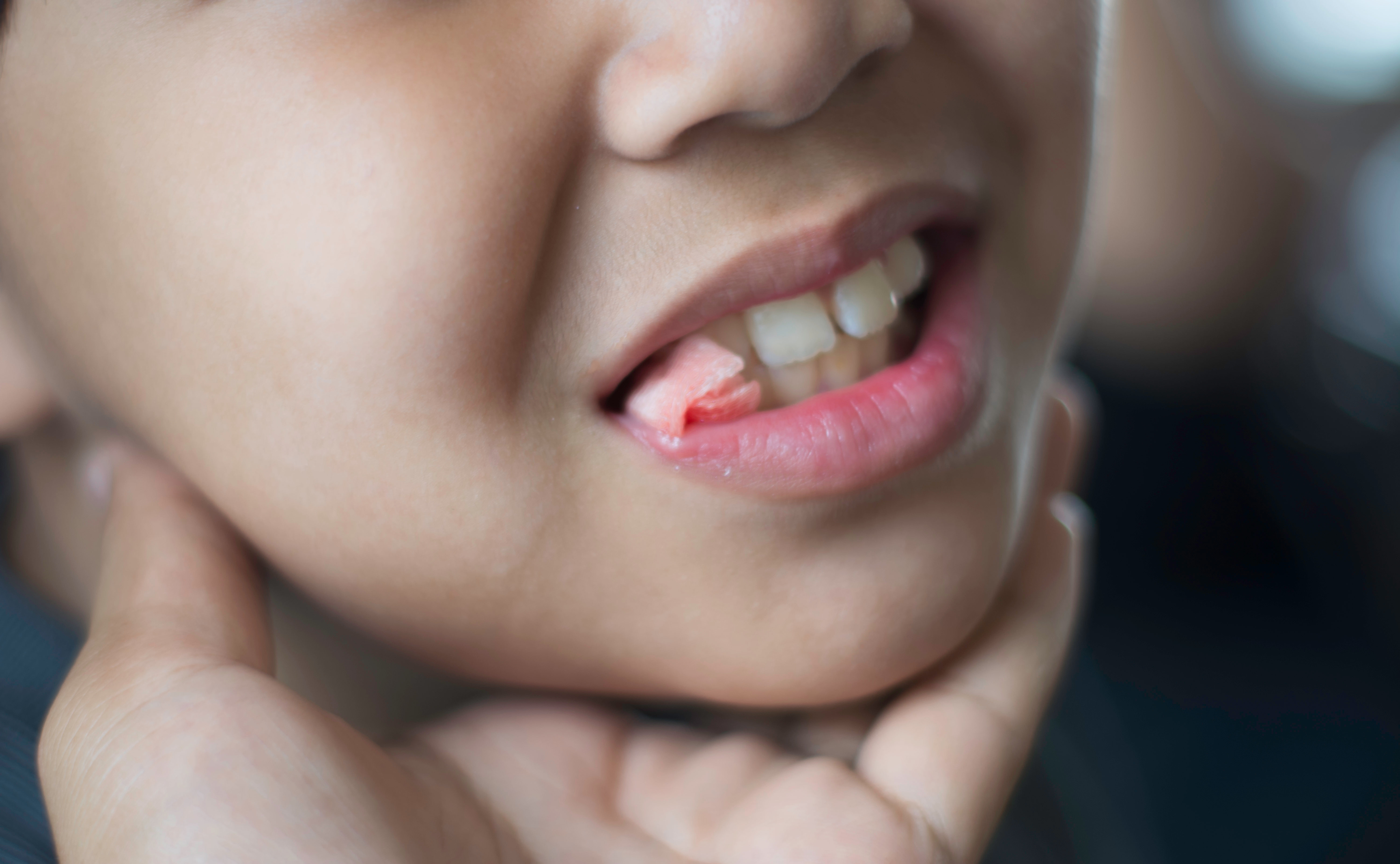 удаление зуба у ребенка