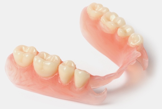 Протезирование при частичной потере зубов