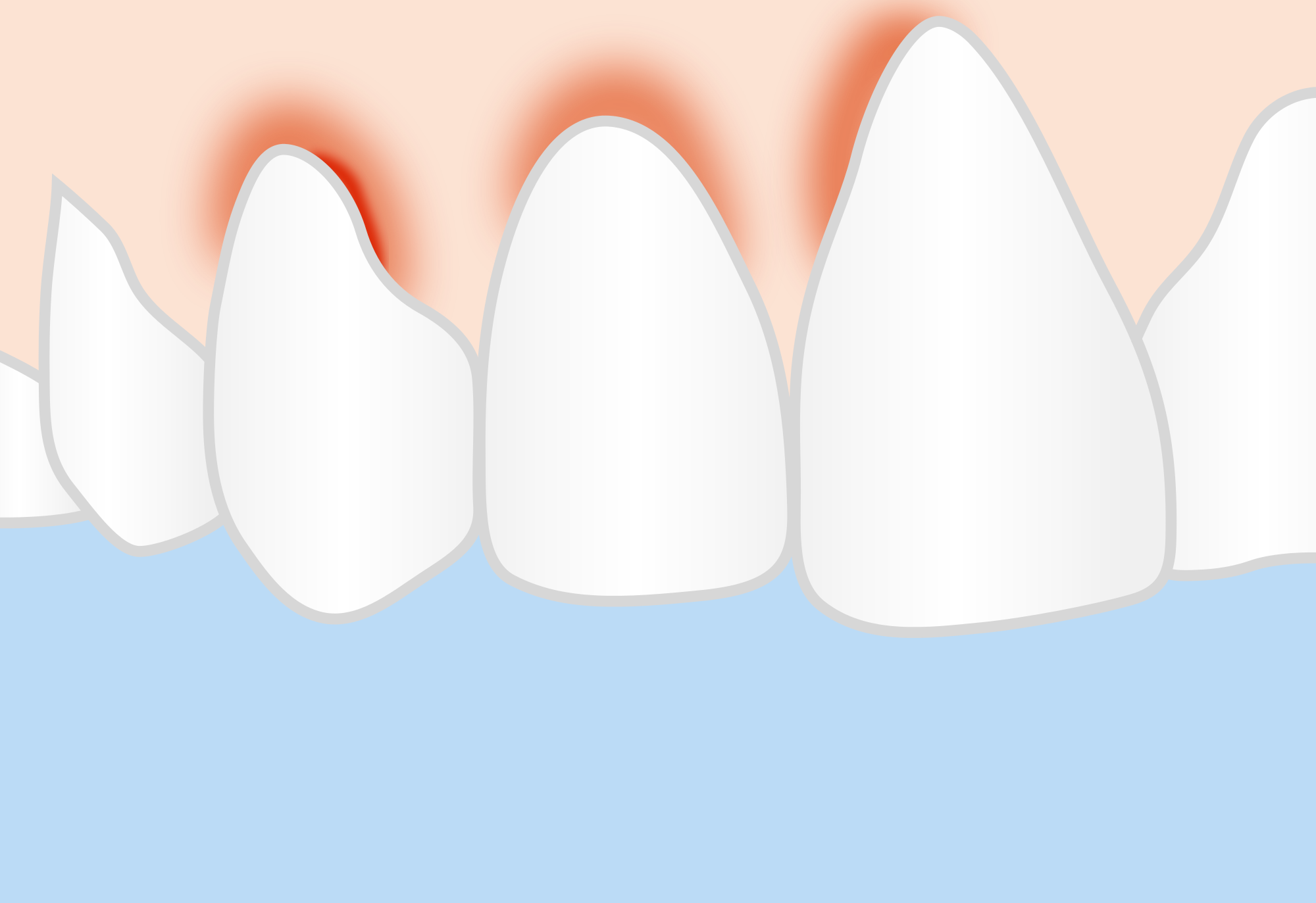 Изображение ушиба зуба