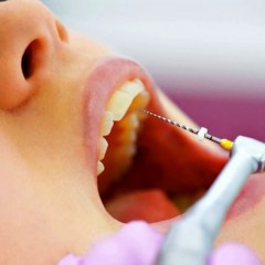 Особенности лечения корневых каналов зуба