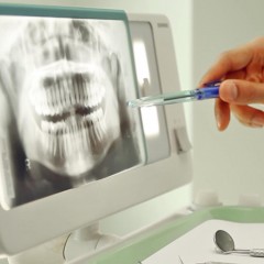 Рентгенодиагностика зубов в стоматологии