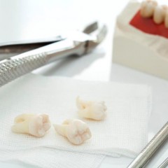 Удаление нескольких зубов