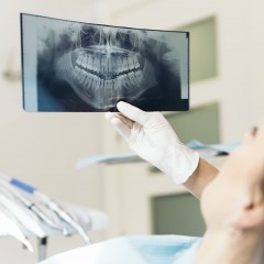 Панорамный снимок зубов в руке
