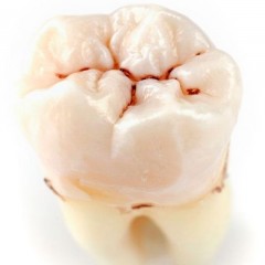 Фото зуба с фиссурным кариесом