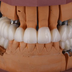 Фото челюсти с искусственными зубами