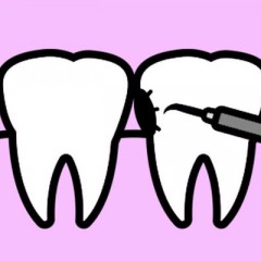 Картинка кариеса зубов