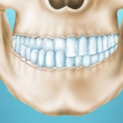 Изображение челюсти с перекрестным прикусом