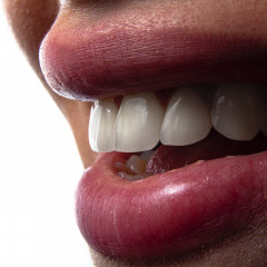 Фото искусственные зубы