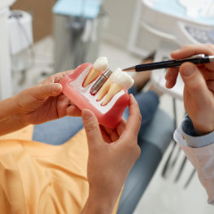 Стоматолог демонстрирует зубной имплант