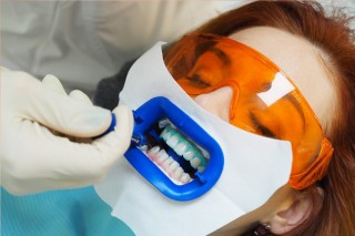 Особенности отбеливания зубов методом ZOOM