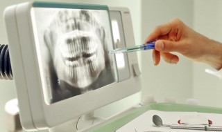 Рентгенодиагностика зубов в стоматологии