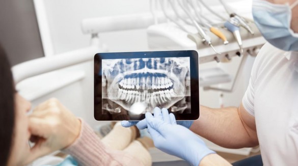 Врач показывает пациенту панорамный снимок зубов