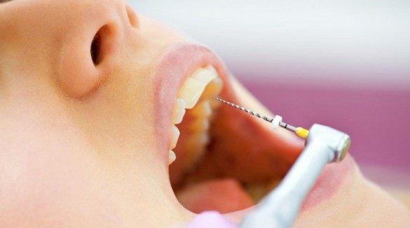 Подготовка к удалению зубного нерва