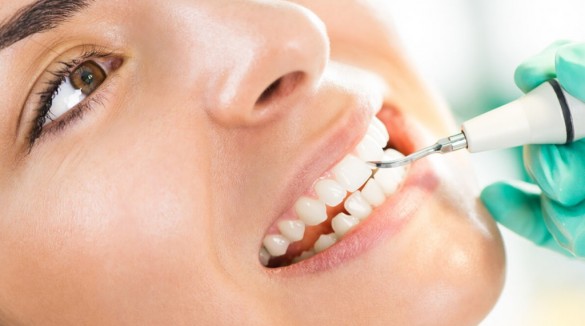 Фото врач чистит зубы пациенту ультразвуком