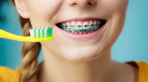 Девочка чистит зубы с брекетами